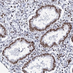 Matrin 3 Antibody, Novus Biologicals 25 &mu;L | Buy Online | Novus Biologicals | Fisher Scientific